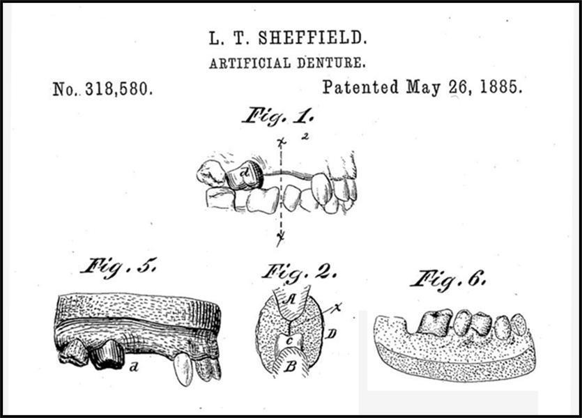 Patent 318580
