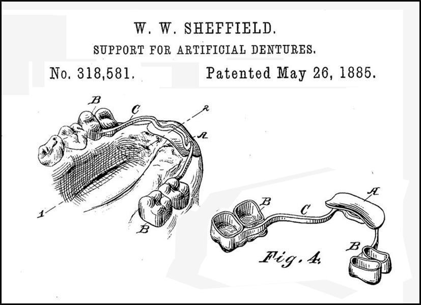 Patent 318581